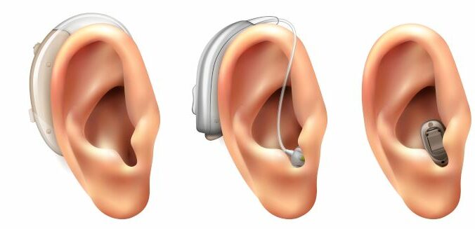 différentes formes d'appareils auditifs : contour d'oreille (ou bte), écouteur déporté (ou ric/rite) et intra-auriculaire (ou ITE)